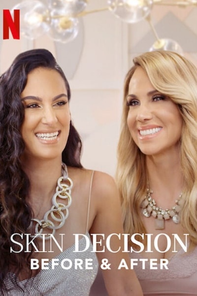 Skin Decision: Before and After&nbsp;- Season 1